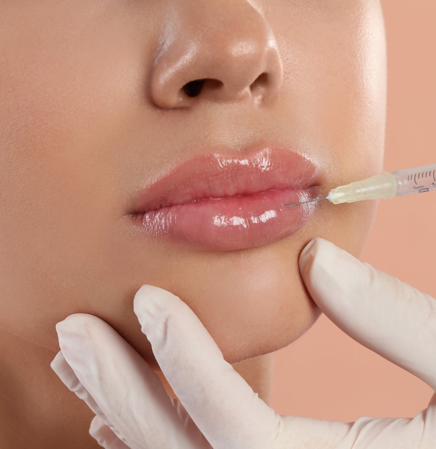 LIP_FILLER